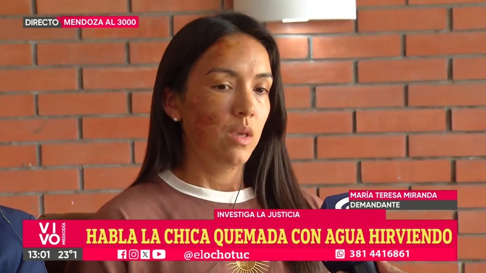 Habló la hermana de Jorgito Barrionuevo, que sufrió quemaduras con agua hirviendo en el rostro: “Ya me habían amenazado antes”